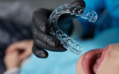 Allineatori dentali trasparenti: perché lo Studio Dieni sceglie il metodo Invisalign e Spark